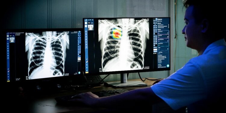 VinBrain and Global Fund continue joining forces to tackle Vietnam’s tuberculosis challenge through AI in 2024