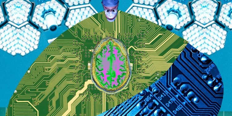 Your Next Job: Brain-Computer Interface Surgeon