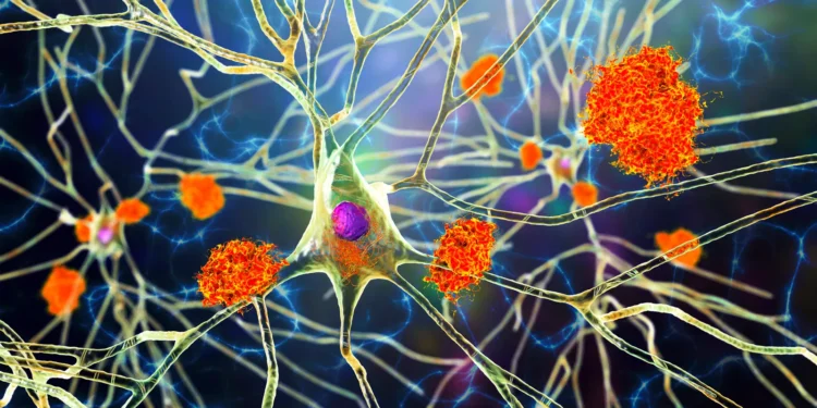 Roche weighs whether speedy approval path is open for latest Alzheimer’s drug