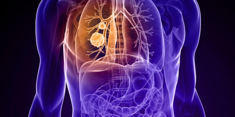 AstraZeneca, Daiichi revise approval plans for Enhertu successor