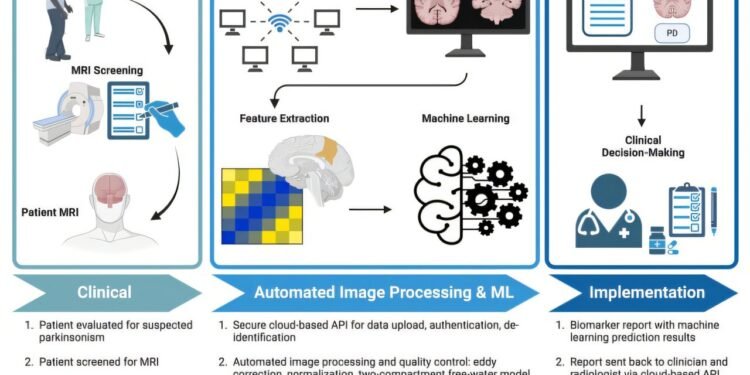 AI-driven software is 96% accurate at diagnosing Parkinson’s