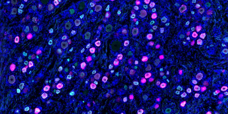 Latigo raises $150M to get non-opioid pain drugs through key tests