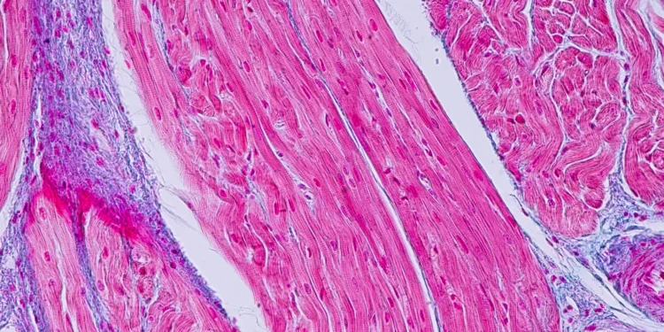 Patient dies in trial of Rocket gene therapy for heart condition