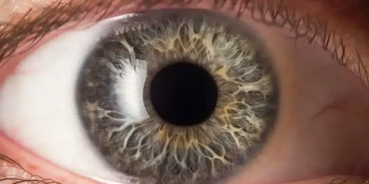 Sam Altman Launches Iris Scanning Orb In The U.S.