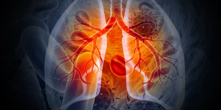 Chasing rivals, Nuvalent to seek approval of targeted lung cancer drug