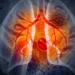Chasing rivals, Nuvalent to seek approval of targeted lung cancer drug