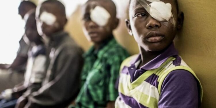 Senegal overcomes a century-old problem