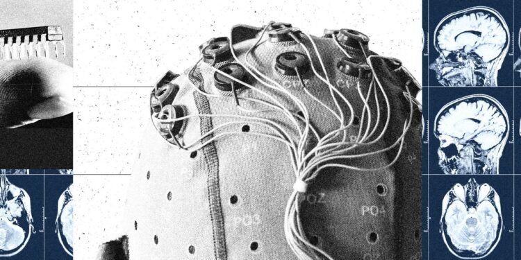 China Is Building a Brain-Computer Interface Industry