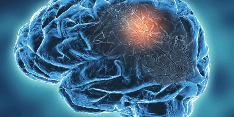 Novartis thinks Arrowhead brain drug can succeed where others couldn’t