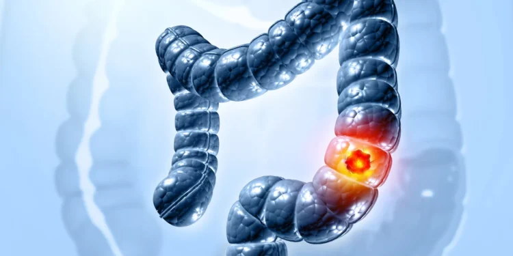 Cartography secures $67M in pursuit of ‘differentiated’ cancer drugs