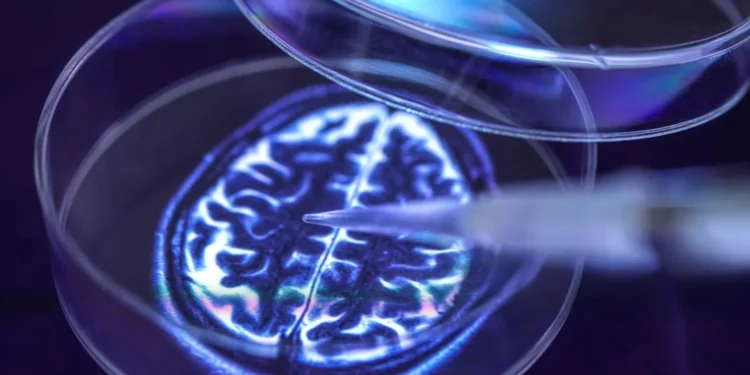 AC Immune posts positive data for Parkinson’s immunotherapy