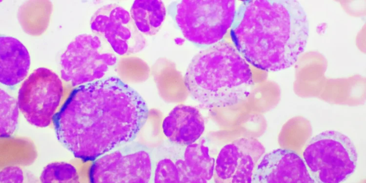 Terns drug shows potential to challenge Novartis’ blockbuster leukemia treatment