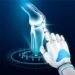 AI-Driven X-Ray Innovation Accelerates Early Arthritis Detection
