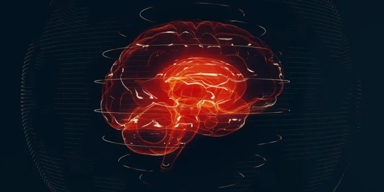 AI reads brain MRIs in seconds and flags emergencies