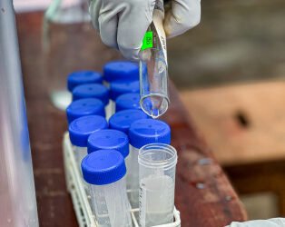 African Development Bank Group funds regional health resilience drive in Southern Africa