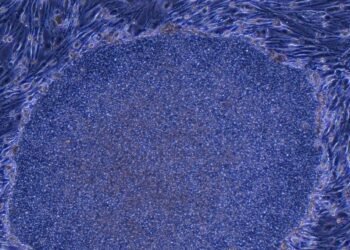 Japan Approves the World’s First Treatment Made With Reprogrammed Human Cells