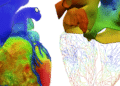 Living Heart Project Builds Virtual Twins for Medicine
