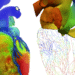 Living Heart Project Builds Virtual Twins for Medicine